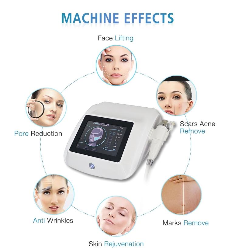 Microneedling-Maschiene-für-microneedling-gegen-Falten-und-Akne-jetzt-online-kaufen.